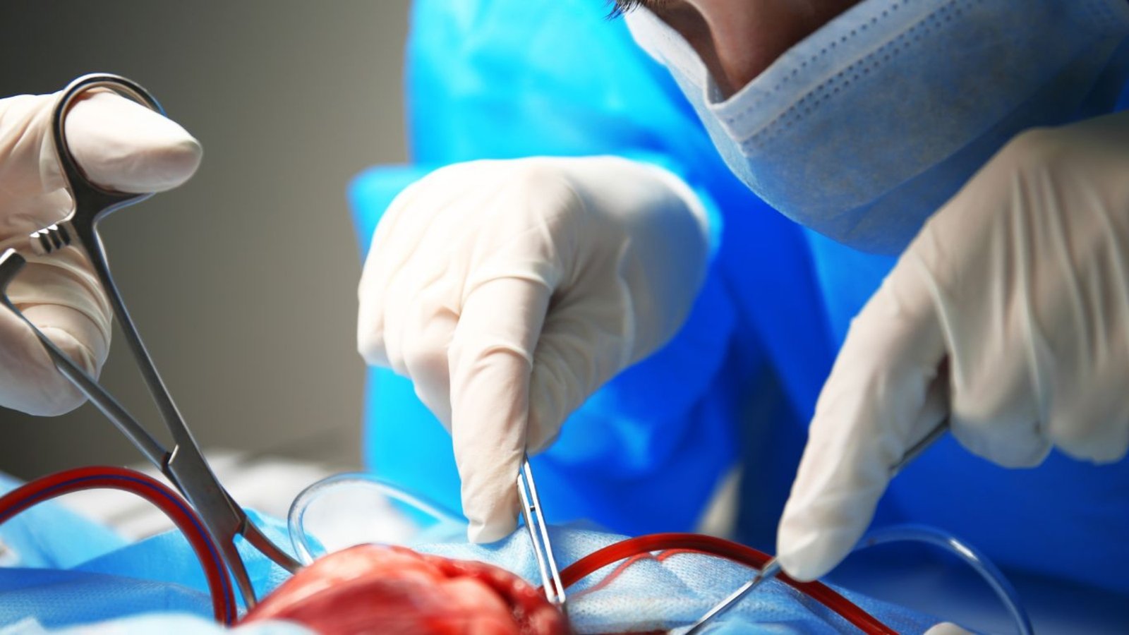 Puebla registra más de 2 mil pacientes en espera de trasplante; demoras alcanzan hasta 18 años